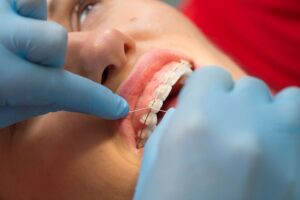 Wizyty kontrolne u ortodonty. Cena. Brzesko Bochnia