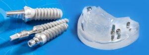 Implant zęba. Implanty zębów. Uzupełnienie braków zębowych. Brzesko Bochnia