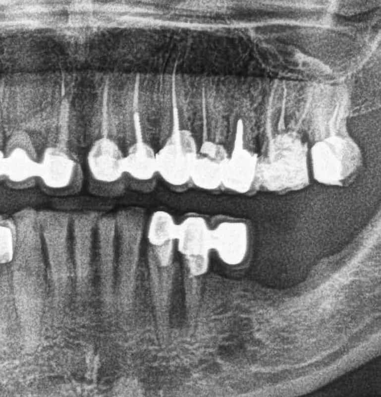 panorama endodoncja