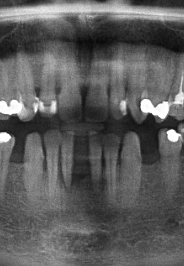 zdjęcie panoramiczne periodontologia